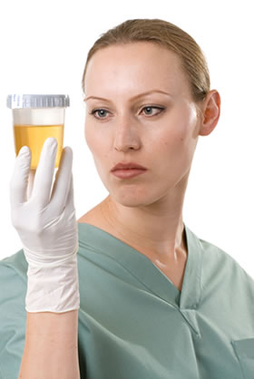 Random Drug Testing